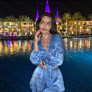 Фото 4 — Николь, 26 лет, 174 см, 54 кг, Электросталь